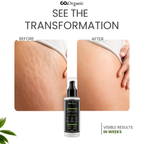 Stretch Mark Serum